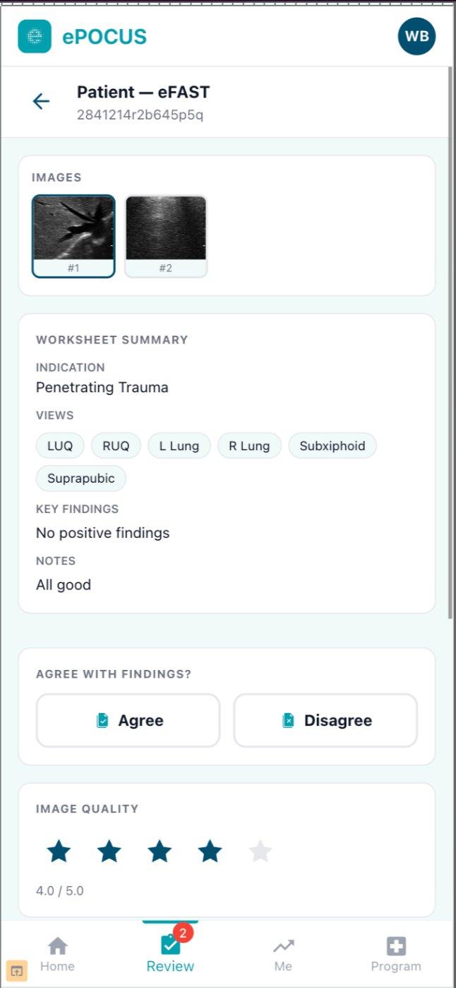 ePOCUS specialist review screen showing an eFAST study with saved images, a worksheet summary listing indication, views and key findings, an agree or disagree control, and a five-star image quality score