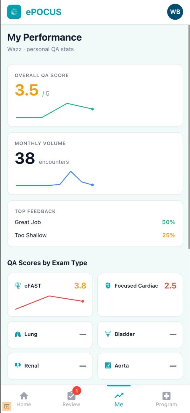 ePOCUS clinician performance view showing an overall QA score of 3.5 out of 5 with a trend line, monthly scan volume, most common feedback themes, and QA scores broken down by exam type