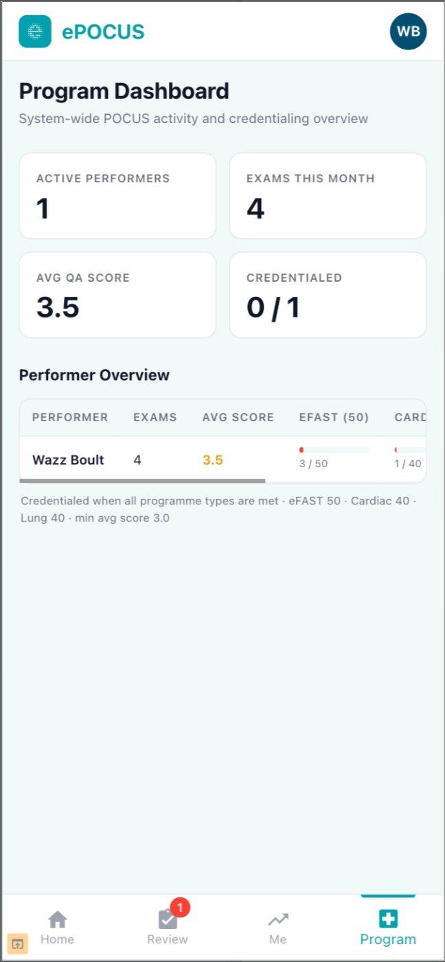 ePOCUS programme dashboard showing active performers, exams this month, average QA score and number credentialed, with a per-clinician table showing progress toward per-application scan thresholds