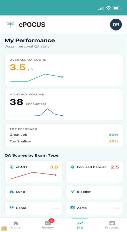 ePOCUS clinician performance view showing an overall QA score of 3.5 out of 5 with a trend line, monthly scan volume, most common feedback themes, and QA scores broken down by exam type